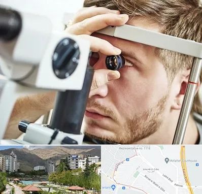 فوق تخصص قرنیه در شهر زیبا 