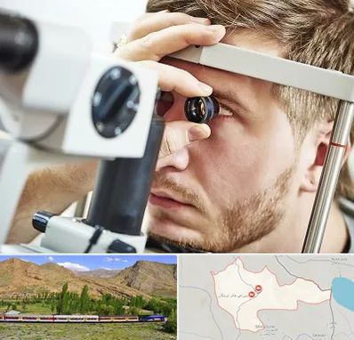 فوق تخصص قرنیه در خاش