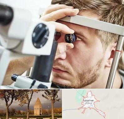 فوق تخصص قرنیه در تویسرکان