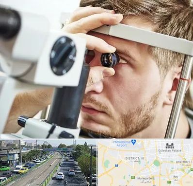 فوق تخصص قرنیه در جنوب تهران 