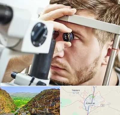 فوق تخصص قرنیه در کامیاران