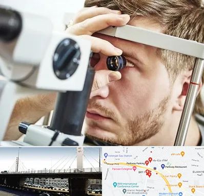 فوق تخصص قرنیه در پارک وی 