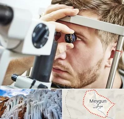 فوق تخصص قرنیه در میگون