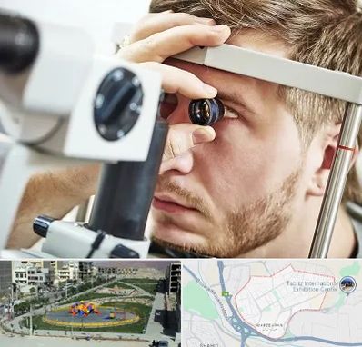 فوق تخصص قرنیه در مرزداران تبریز