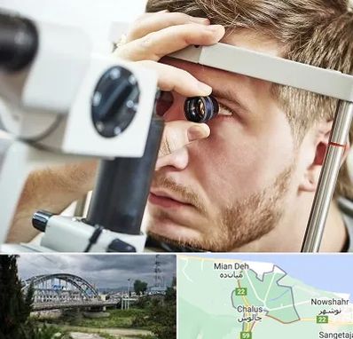 فوق تخصص قرنیه در چالوس