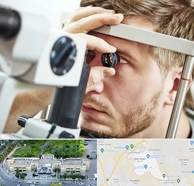 فوق تخصص قرنیه در نسیم شهر