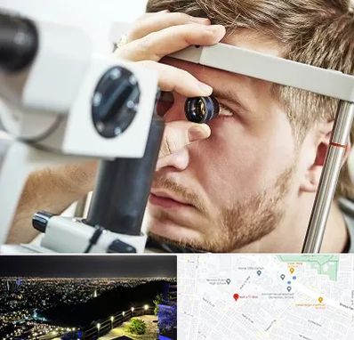 فوق تخصص قرنیه در هفت تیر مشهد 