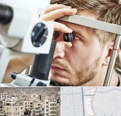 فوق تخصص قرنیه در اسکندری