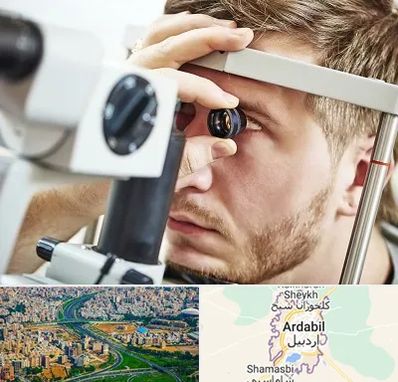 فوق تخصص قرنیه در اردبیل