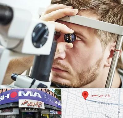 فوق تخصص قرنیه در امین حضور