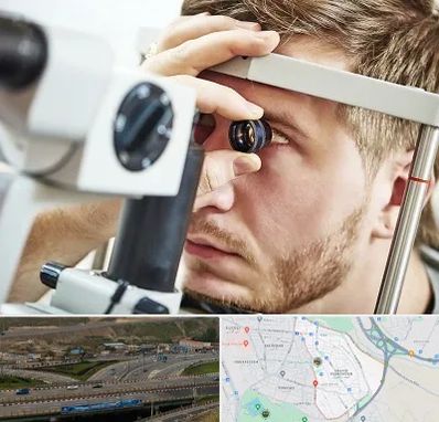 فوق تخصص قرنیه در یاغچیان تبریز