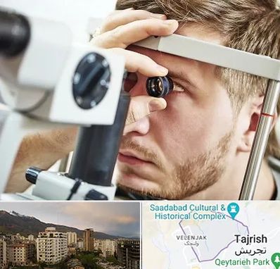 فوق تخصص قرنیه در زعفرانیه 