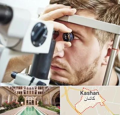 فوق تخصص قرنیه در کاشان