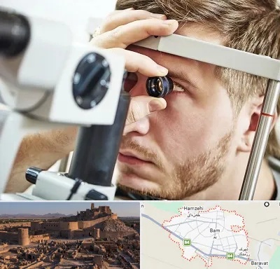 فوق تخصص قرنیه در بم