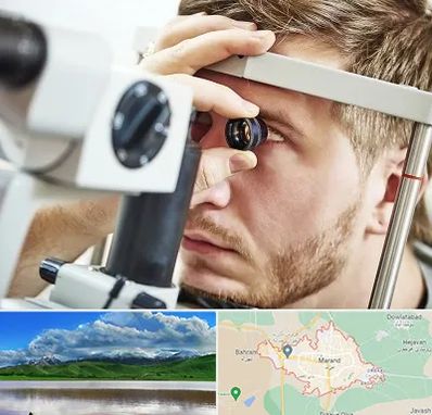 فوق تخصص قرنیه در مرند