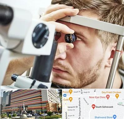 فوق تخصص قرنیه در سهروردی 