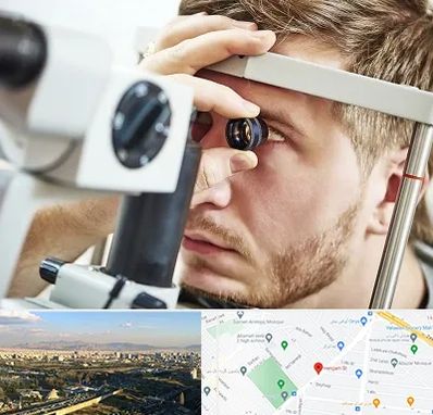 فوق تخصص قرنیه در هنگام 