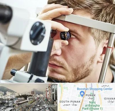 فوق تخصص قرنیه در پونک 