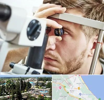 فوق تخصص قرنیه در رودسر