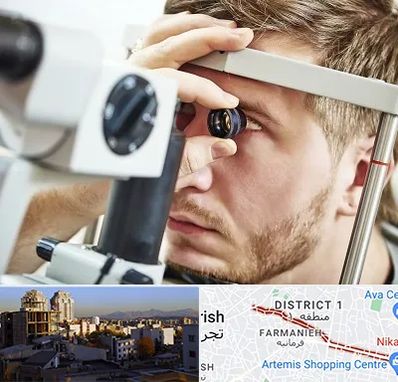 فوق تخصص قرنیه در فرمانیه 