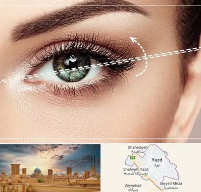 جراحی چشم گربه ای در یزد