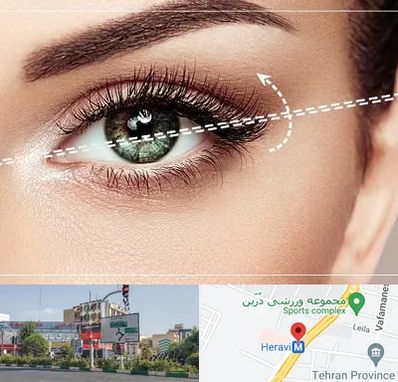 جراحی چشم گربه ای در هروی 