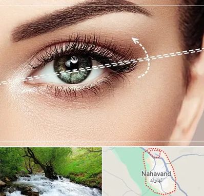 جراحی چشم گربه ای در نهاوند