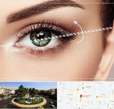 جراحی چشم گربه ای در هفت حوض 