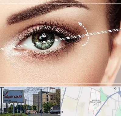 جراحی چشم گربه ای در فاز یک اندیشه