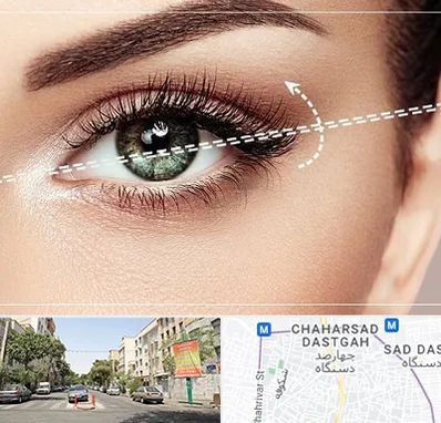 جراحی چشم گربه ای در چهارصد دستگاه 