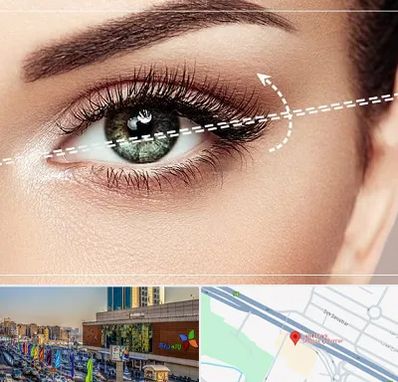 جراحی چشم گربه ای در لاله پارک تبریز