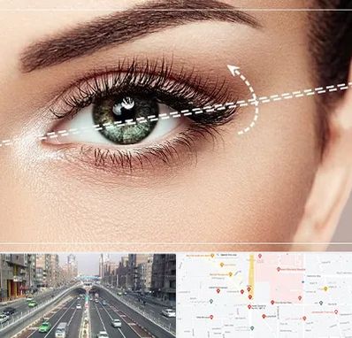 جراحی چشم گربه ای در توحید 