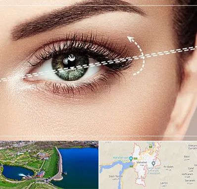 جراحی چشم گربه ای در مهاباد