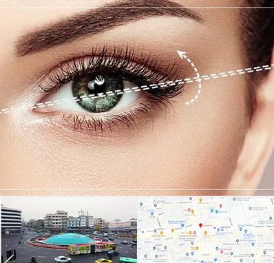 جراحی چشم گربه ای در میدان انقلاب 