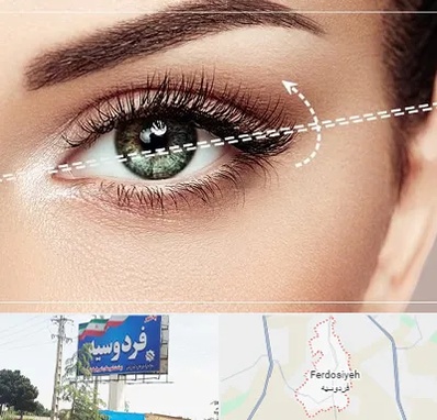 جراحی چشم گربه ای در فردوسیه شهریار