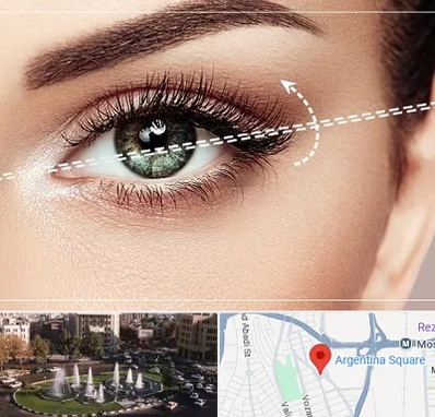 جراحی چشم گربه ای در آرژانتین