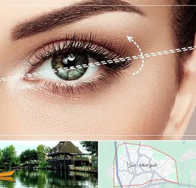 جراحی چشم گربه ای در صومعه سرا