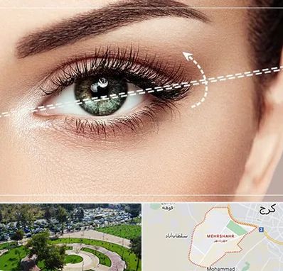 جراحی چشم گربه ای در مهرشهر کرج 