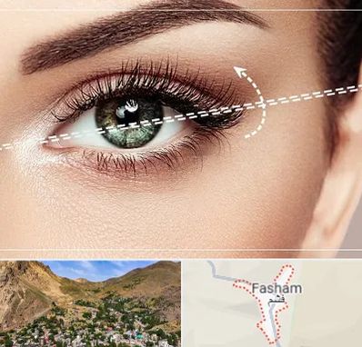 جراحی چشم گربه ای در فشم