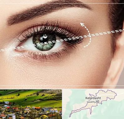 جراحی چشم گربه ای در کلاردشت