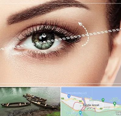 جراحی چشم گربه ای در بندر انزلی