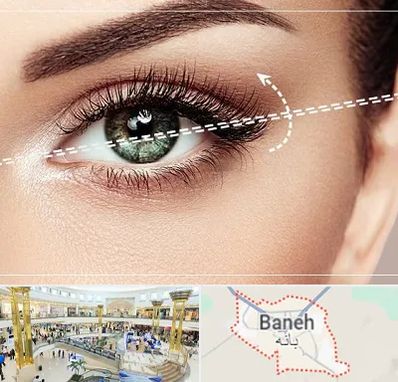 جراحی چشم گربه ای در بانه