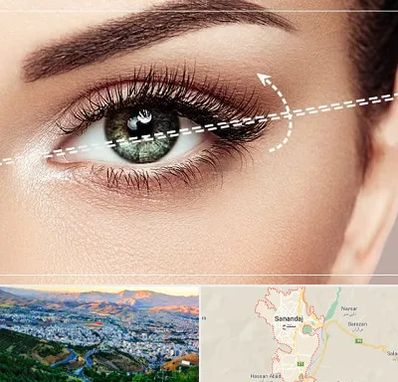 جراحی چشم گربه ای در سنندج