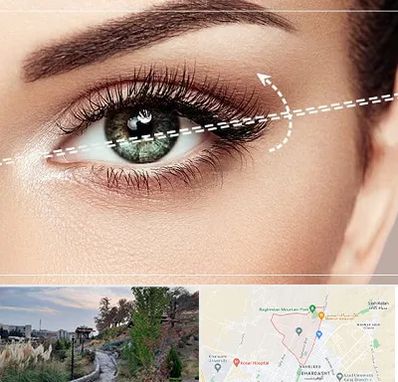 جراحی چشم گربه ای در باغستان کرج