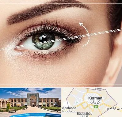 جراحی چشم گربه ای در کرمان