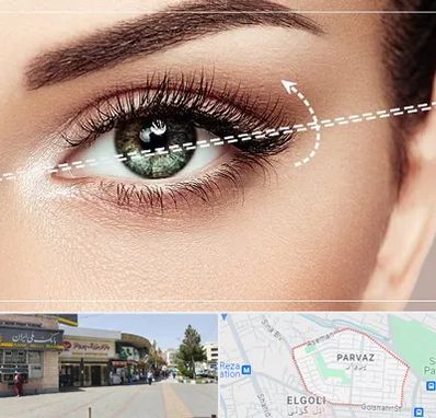 جراحی چشم گربه ای در پرواز تبریز