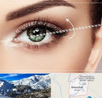 جراحی چشم گربه ای در شمشک