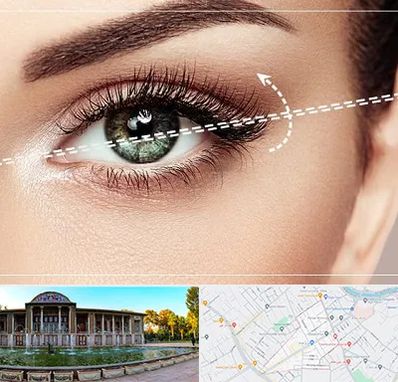 جراحی چشم گربه ای در عفیف آباد شیراز