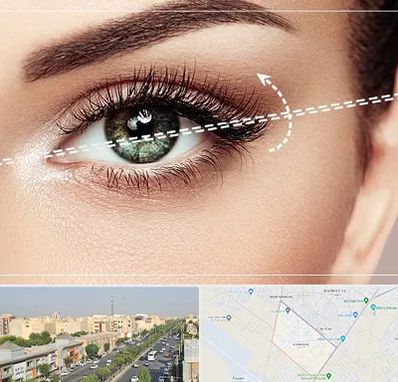 جراحی چشم گربه ای در کیانمهر کرج