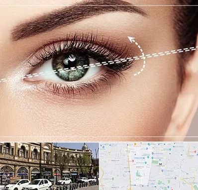 جراحی چشم گربه ای در منطقه 11 تهران 